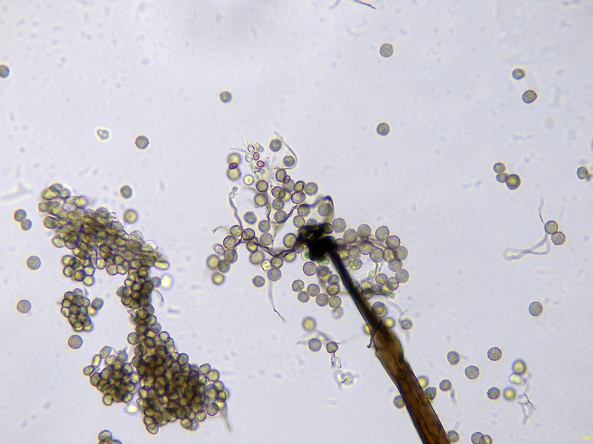 Microscopía de Stemonaria fuscoides - 10 - Apice columela x 400  agua-001